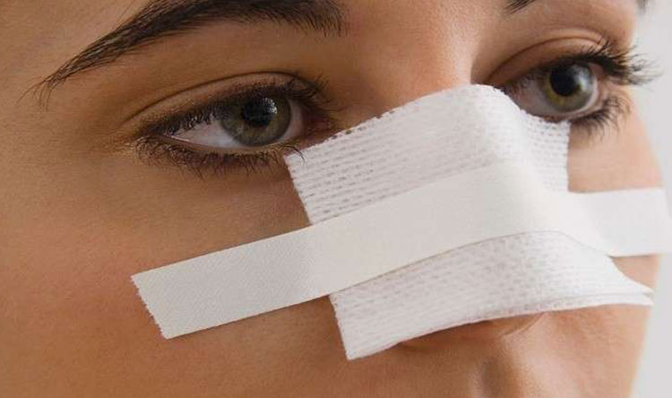تجميل الأنف بـ 5 دقائق ودون جراحة!