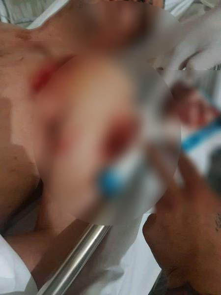 إصابة جراء إطلاق نار في الشويفات - صورة مموهة