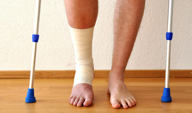 7 أطعمة تساعد عظامك المكسورة على الإلتئام... فما هي؟
