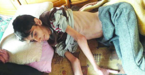 محمد شعبان توفي أمس في مضايا بريف دمشق بعد أن منعته سلطات الأسد من تلقي العلاج خارج البلدة